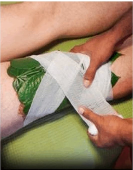 Vestanam — medicated bandage therapy